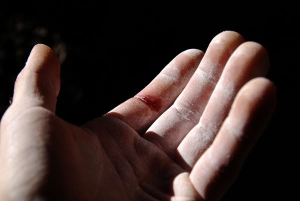 Outsch, time for a restday! © Photo by Emanuel Moosburger