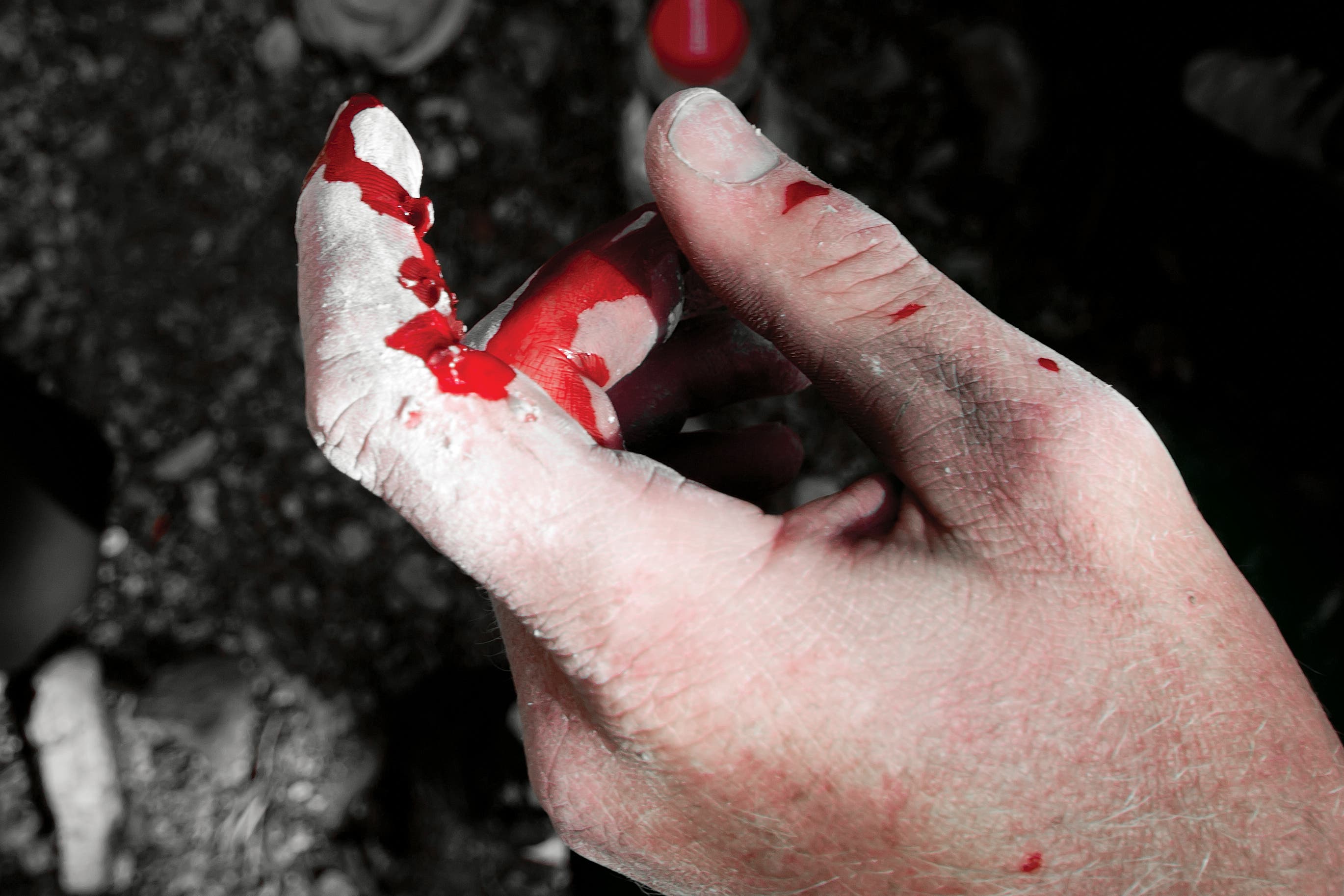 JoePrescott_gn.jpg Flapper Rock Climbing Finger Skin Injury