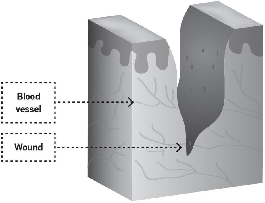 A Dermatologist's Tricks For Healing Skin Injuries From Climbing