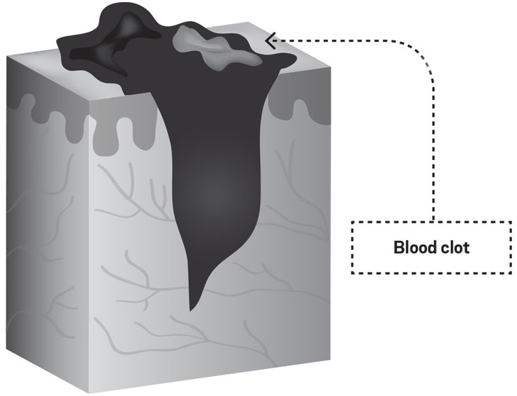 Wound2.jpg Skin healing cycle illustration