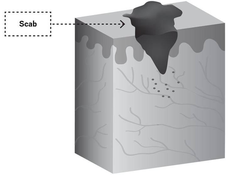 Wound3.jpg Skin healing cycle illustration