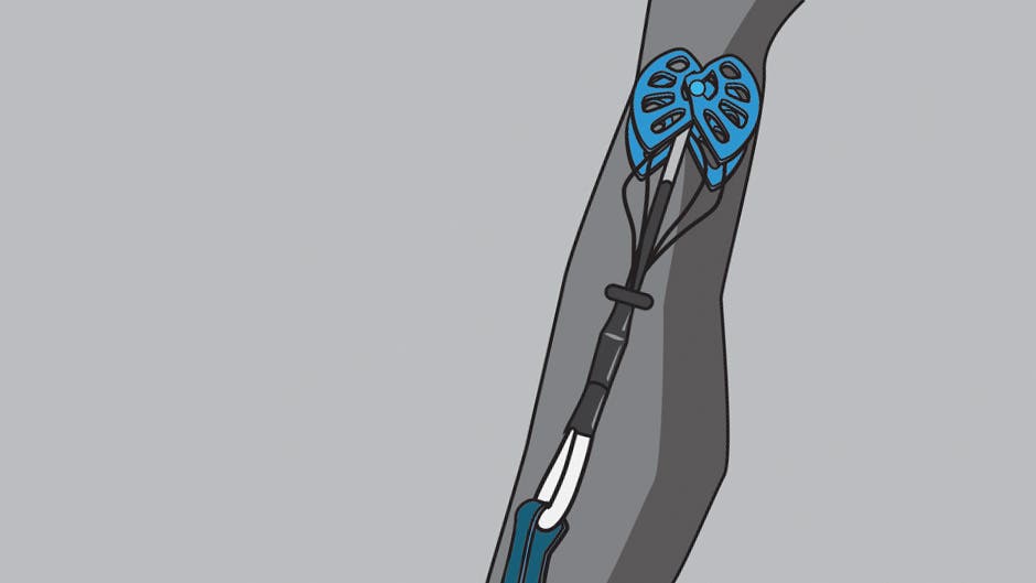 PromoCamTrad.jpg A well-placed cam in a crack