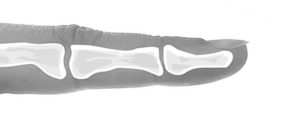 FingerBody Rock Climbing Fingertip Pulp Finger Anatomy