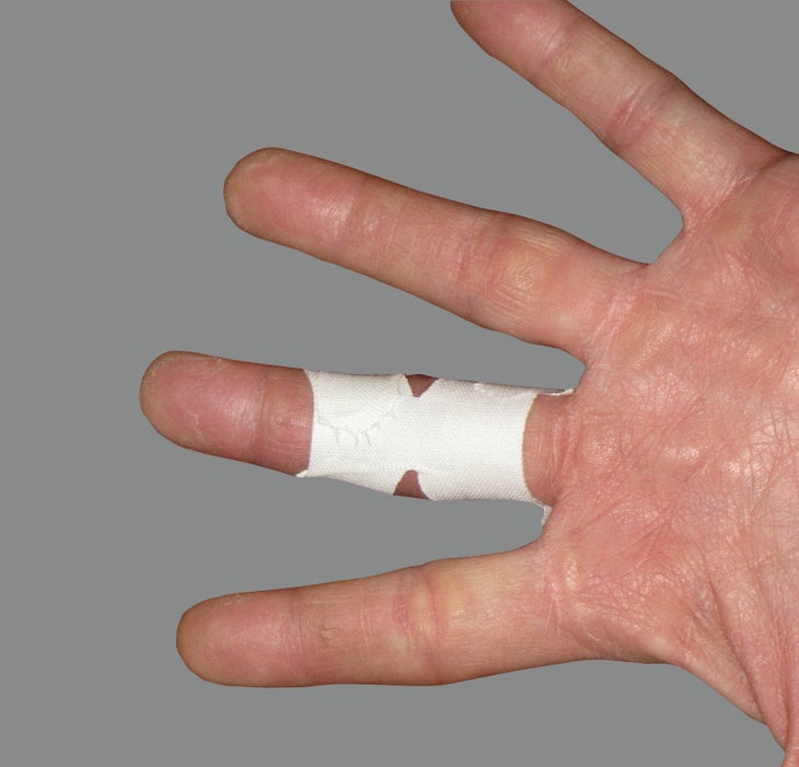 Finger injuries: what you need to know about taping - KletterRetter - Climb  more. Climb better.
