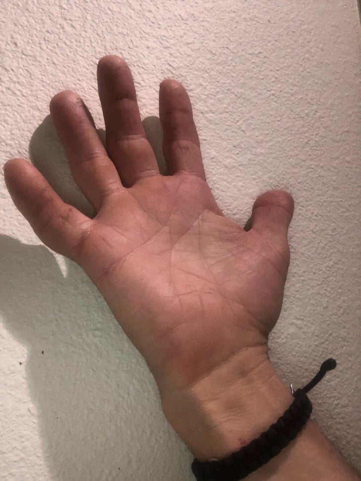 Matt Samet fingers
