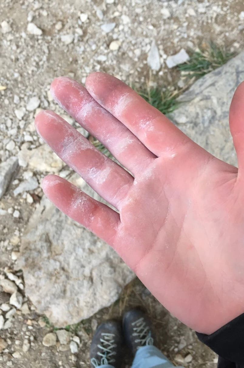 Delaney Miller's Fingers