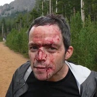 Man with face covered in blood after he climbed without a helmet.