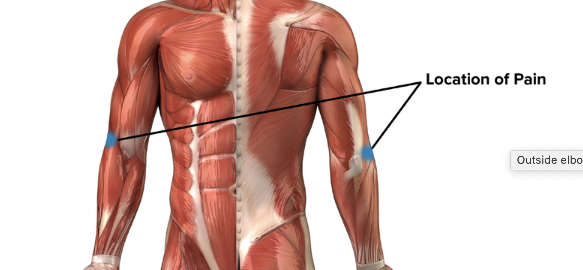 The Bible For Your Elbows. Train, Rehab, Repent! Climbing