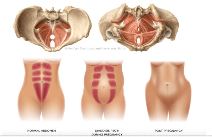 Learn the way to Return to Climbing After Being pregnant