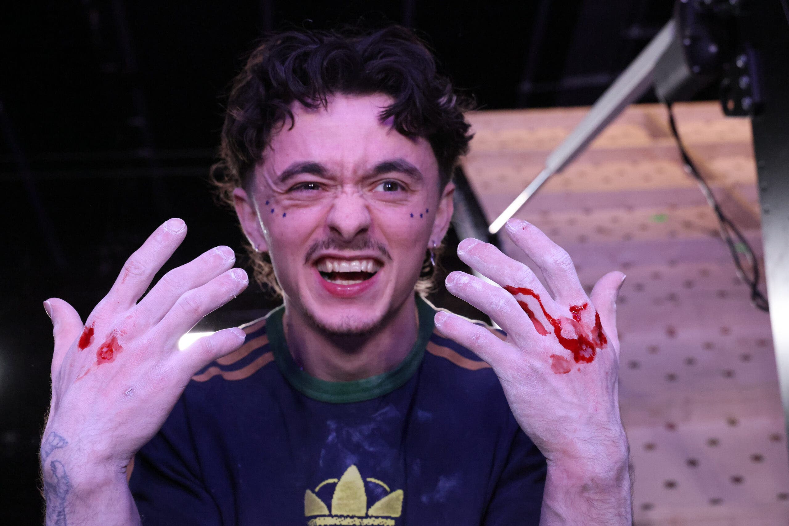 First-place winner Max Milne poses with two bloody hands after hand jamming the plastic to beat the USA's Colin Duffy in the men's final.